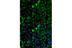 Immunofluorescence analysis of A-549 cells using Cytokeratin 17 (Cytokeratin 17 (KRT17)) antibody (ABIN3023123, ABIN3023124, ABIN3023125 and ABIN6219401). (KRT17 抗体  (AA 133-432))