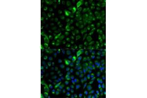 Immunofluorescence analysis of A-549 cells using Cytokeratin 17 (Cytokeratin 17 (KRT17)) antibody (ABIN3023123, ABIN3023124, ABIN3023125 and ABIN6219401). (KRT17 抗体  (AA 133-432))