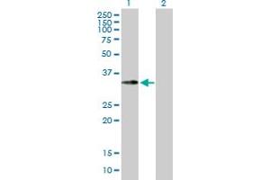Western Blot analysis of EMD expression in transfected 293T cell line by EMD MaxPab polyclonal antibody. (Emerin 抗体  (AA 1-254))