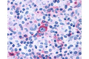 Anti-GPR97 antibody IHC of human Lymph Node, Hodgkins Lymphoma. (GPR97 抗体  (Extracellular Domain))