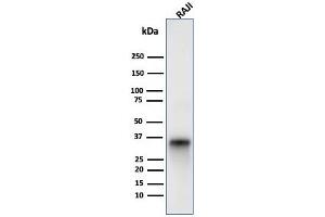 Western blot analysis of Raji cell lysate using CD74 Mouse Monoclonal Antibody (LN-2). (CD74 抗体)