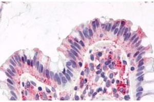 Immunohistochemistry (Formalin/PFA-fixed paraffin-embedded sections) of human colon, surface epithelium with GPR15 polyclonal antibody . (GPR15 抗体  (1st Cytoplasmic Domain))