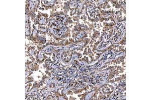 IHC analysis of TTC7B using anti-TTC7B antibody (ABIN7601050). (TTC7B 抗体  (AA 275-730))