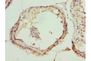 Immunohistochemistry of paraffin-embedded human testis tissue using ABIN7144998 at dilution of 1:100 (DDX55 抗体  (AA 101-400))