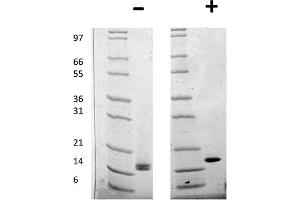 SDS-PAGE of Human Fibroblast Growth Factor acidic Recombinant Protein SDS-PAGE of Human Fibroblast Growth Factor acidic Recombinant Protein. (FGF acidic 蛋白)