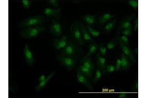 Immunofluorescence (IF) image for anti-Cyclin-Dependent Kinase 6 (CDK6) antibody (ABIN781963) (CDK6 抗体)