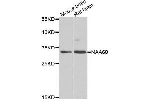 Western blot analysis of extracts of mouse brain and rat brain cell lines, using NAA60 antibody. (NAT15 抗体)