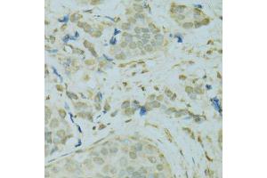 Immunohistochemistry (Paraffin-embedded Sections) (IHC (p)) image for anti-Scaffold Attachment Factor B (SAFB) (AA 1-200) antibody (ABIN6147357)