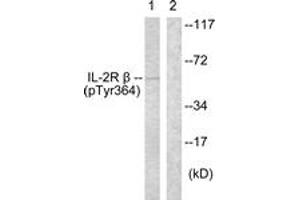 Western blot analysis of extracts from HeLa cells, using IL-2R beta (Phospho-Tyr364) Antibody. (IL2 Receptor beta 抗体  (pTyr364))