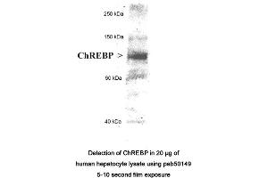 Image no. 2 for anti-MLX Interacting Protein-Like (MLXIPL) (AA 800-852), (C-Term), (Isoform 1) antibody (ABIN363458)