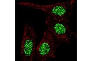 Fluorescent confocal image of HeLa cells stained with KLF4 antibody at 1:100. (KLF4 抗体  (AA 481-504))