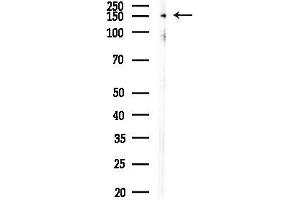 anti-TAO Kinase 2 (TAOK2) (pSer181) antibody