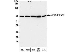 anti-Eukaryotic Translation Initiation Factor 3, Subunit D (EIF3D) (AA 150-200) antibody