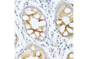 Immunohistochemistry of paraffin-embedded human colon using PRKCA antibody (ABIN5970097) at dilution of 1/100 (40x lens). (PKC alpha 抗体  (C-Term))