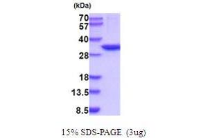 CA13 Protein (AA 1-262) (His tag)