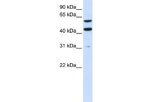 WB Suggested Anti-PTDSS1 Antibody Titration:  0. (PTDSS1 抗体  (N-Term))