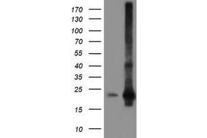 HEK293T cells were transfected with the pCMV6-ENTRY control (Left lane) or pCMV6-ENTRY SAT2 (Right lane) cDNA for 48 hrs and lysed. (SAT2 抗体)