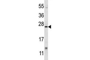 XBP1 antibody western blot analysis in mouse lung tissue lysate. (XBP1 抗体  (AA 217-244))