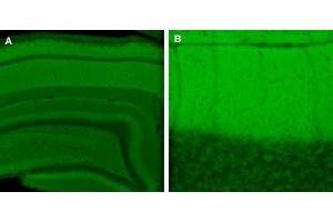 Indirect immunolabeling of PFA fixed rat hippocampus (A) and cerebellum (B) sections. (SNAP47 抗体)