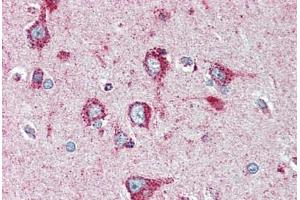 Human Brain, Cortex (formalin-fixed, paraffin-embedded) stained with SOD2 antibody ABIN396955 at 1:50 followed by biotinylated anti-mouse IgG secondary antibody ABIN481714, alkaline phosphatase-streptavidin and chromogen. (SOD2 抗体)