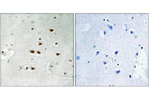 Immunohistochemical analysis of paraffin-embedded human brain tissue using ITCH (Phospho-Tyr420) antibody (left)or the same antibody preincubated with blocking peptide (right).