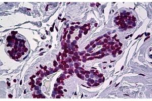 Human Breast: Formalin-Fixed, Paraffin-Embedded (FFPE) (EN1 抗体  (AA 266-392))