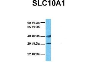 Western Blotting (WB) image for anti-Solute Carrier Family 10 (Sodium/bile Acid Cotransporter Family), Member 1 (SLC10A1) (Middle Region) antibody (ABIN2777141)