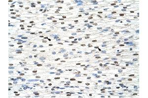 NXF3 antibody was used for immunohistochemistry at a concentration of 4-8 ug/ml to stain Myocardial cells (arrows) in Human Heart. (NXF3 抗体  (C-Term))