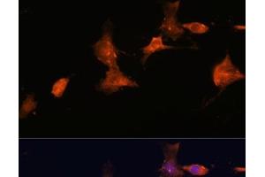 Immunofluorescence analysis of C6 cells using TSC2 Polyclonal Antibody at dilution of 1:100. (Tuberin 抗体)