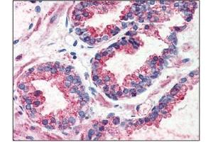 Immunohistochemistry: GPR126 antibody staining of Formalin-Fixed, Paraffin-Embedded Human Prostate. (G Protein-Coupled Receptor 126 抗体  (N-Term))