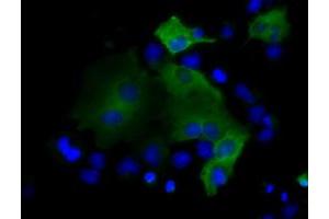 Image no. 7 for anti-Proteasome (Prosome, Macropain) 26S Subunit, ATPase, 3 (PSMC3) antibody (ABIN1501331) (PSMC3 抗体)