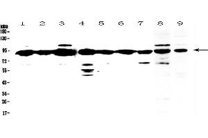 Western blot analysis of XRCC1 using anti-XRCC1 antibody .