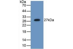 Detection of Recombinant MB21D1, Mouse using Polyclonal Antibody to Mab21 Domain Containing Protein 1 (MB21D1) (C6orf150 抗体  (AA 211-395))