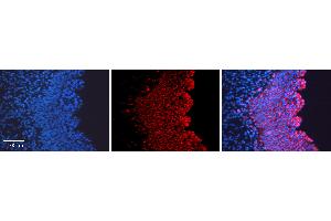 Immunohistochemistry (IHC) image for anti-Sonic Hedgehog (SHH) (N-Term) antibody (ABIN2781775)