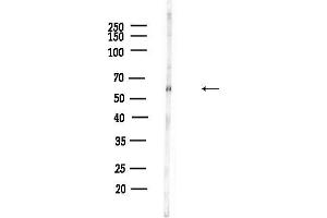 Western blot analysis of lysates from F10-LUC cells(heat-shock,45 min treatment), using Phospho-AK (Thr450) Antibody at 1/1000 dilution.