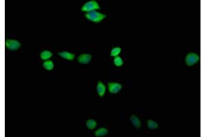 Immunofluorescence staining of Hela cells with ABIN7171907 at 1:200, counter-stained with DAPI. (TTC14 抗体  (AA 569-770))
