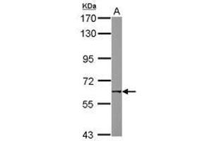Image no. 2 for anti-Nicotinic Acetylcholine Receptor beta (CHRNB1) (AA 274-501) antibody (ABIN1497506) (CHRNB1 抗体  (AA 274-501))