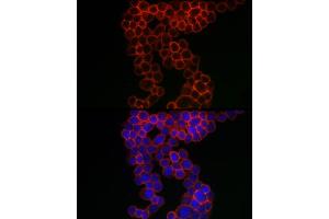 Immunofluorescence analysis of THP-1 cells using CD38 Rabbit pAb (ABIN3015544, ABIN3015545, ABIN1679089 and ABIN6218776) at dilution of 1:100 (40x lens). (CD38 抗体  (AA 1-300))
