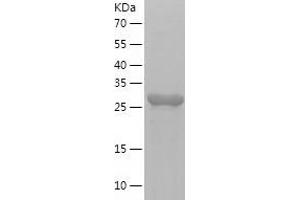 CD34 (CD34) (AA 32-290) protein (His-IF2DI Tag)