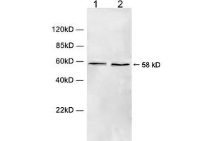 Western blot analysis of cell lysate using 1 µg/mL Rabbit Anti-Chk1 (Ser280) Polyclonal Antibody (ABIN398709) Lane 1: Hela cell lysateLane 2: HEK293 cell lysateThe signal was developed with IRDyeTM 800 Conjugated Goat Anti-Rabbit IgG. (CHEK1 抗体  (Ser280))