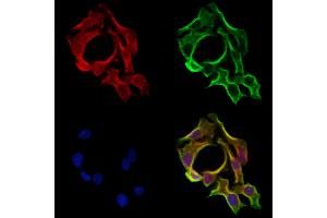 ABIN6265129 and ABIN6273163 staining Hela cells by IF/ICC. (SLC38A3 抗体  (Internal Region))