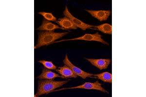 Immunofluorescence analysis of NIH/3T3 cells using IDS Rabbit pAb (ABIN3015633, ABIN3015634, ABIN3015635 and ABIN6218988) at dilution of 1:25 (40x lens).
