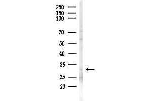 anti-Natural Cytotoxicity Triggering Receptor 3 (NCR3) (Internal Region) antibody