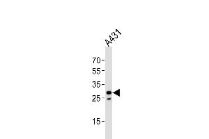 Western blot analysis of lysate from A431 cell line, using RN Antibody (Center) (ABIN651929 and ABIN2840458). (RNF208 抗体  (AA 86-115))