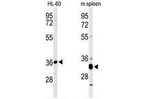LEFT: Western blot analysis of ST8SIA4 Antibody (Center) in HL-60 cell line lysates (35µg/lane). (ST8SIA4 抗体  (Middle Region))