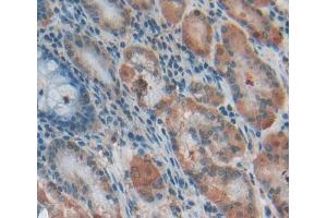 Used in DAB staining on fromalin fixed paraffin- embedded Kidney tissue (TBCA 抗体  (AA 2-108))