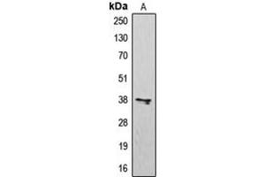 Western blot analysis of CD183 expression in K562 (A) whole cell lysates. (CXCR3 抗体  (Center))