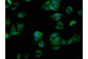 Immunofluorescence staining of HepG2 cells with ABIN7153569 at 1:200, counter-stained with DAPI. (TUBGCP4 抗体  (AA 203-309))