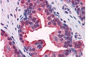 Human Prostate: Formalin-Fixed, Paraffin-Embedded (FFPE) (KEAP1 抗体  (AA 21-70))