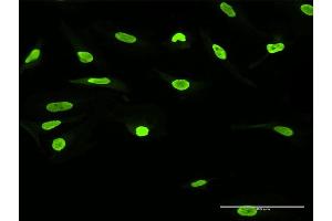 Immunofluorescence of purified MaxPab antibody to SSB on HeLa cell. (SSB 抗体  (AA 1-408))